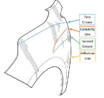Federal Circuit Rules on…